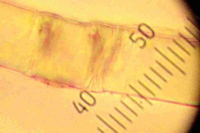 Faser des Abbildes unter dem Mikroskop